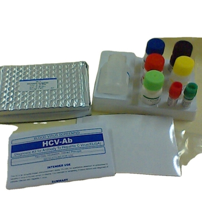 Interleukin 1 Beta-elisa Entdeckungsausrüstung menschliches Il1b Elisa Kit Reaserch Use