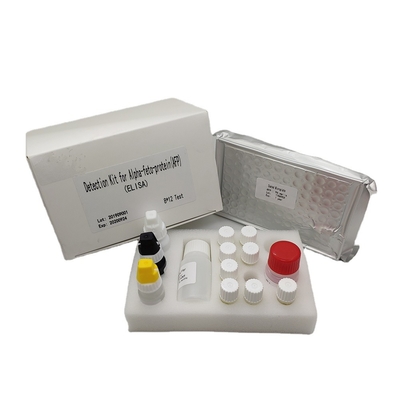 Quantitative Alpha Fetoprotein Elisa Detection Kit AFP im menschlichen Serum