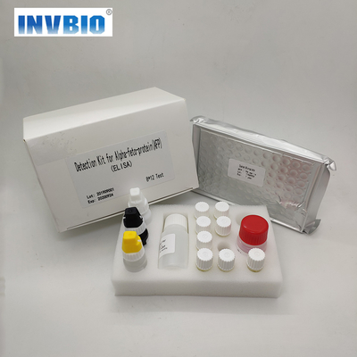Menschliche Alpha Fetoprotein Elisa Test Kit ein Schritt